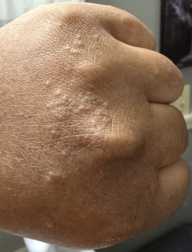 Can anyone help me with skin issue?