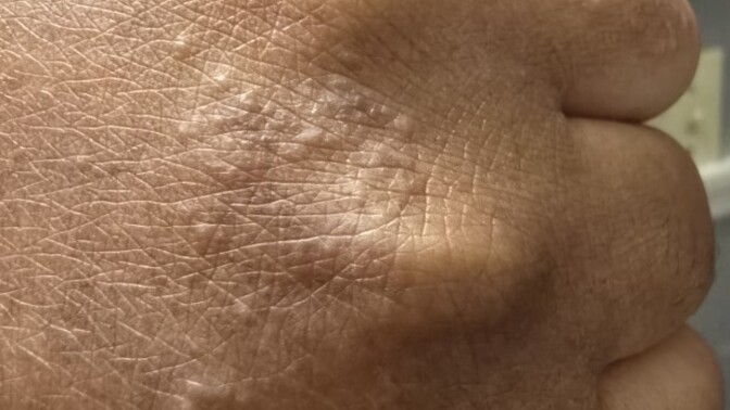 Can anyone help me with skin issue?