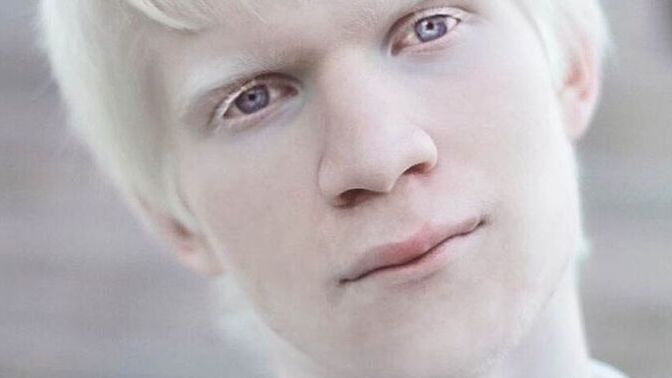 Do you support discrimination, profiling and violence against Male People Of Pallor?