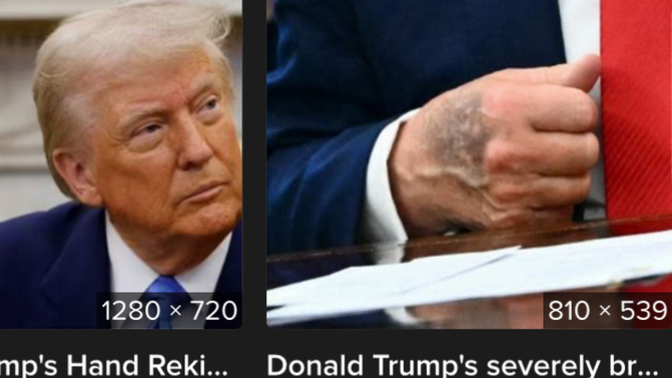 Is Trump dying?