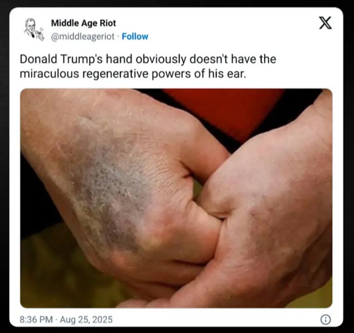 A lot of people are saying... ?