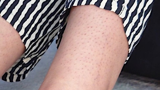 Such skin on a woman?