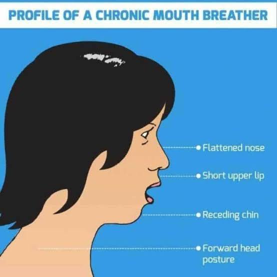How would you respond if someone called you a “mouth breather” ?