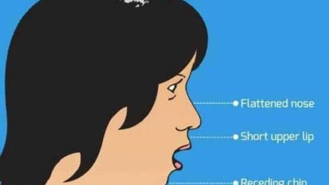 How would you respond if someone called you a “mouth breather” ?