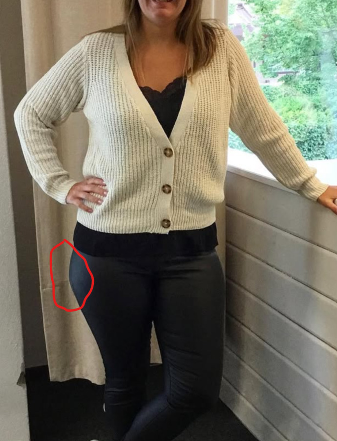 What is this called? Wide hips or thigh fat?