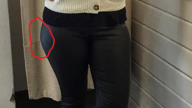 What is this called? Wide hips or thigh fat?