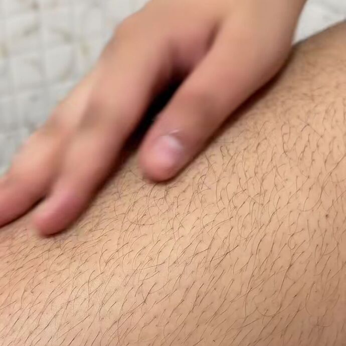 Normal to have such hairy thighs?