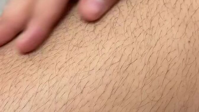 Normal to have such hairy thighs?