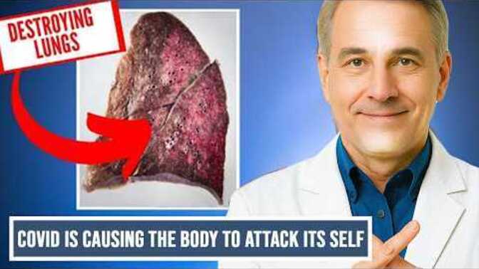 COVID 19 Mystery--Doctors Are Unraveling The Mystery of COVID 19. Did you have COVID 19 or KNOW Someone Still Suffering From This Virus?