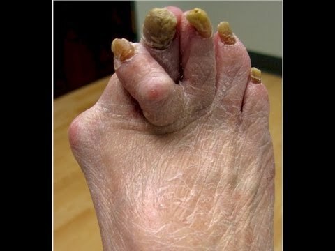I think Latino girls have prettiest feet then white girls don't you?