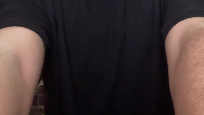 Is there asymmetry in my face?