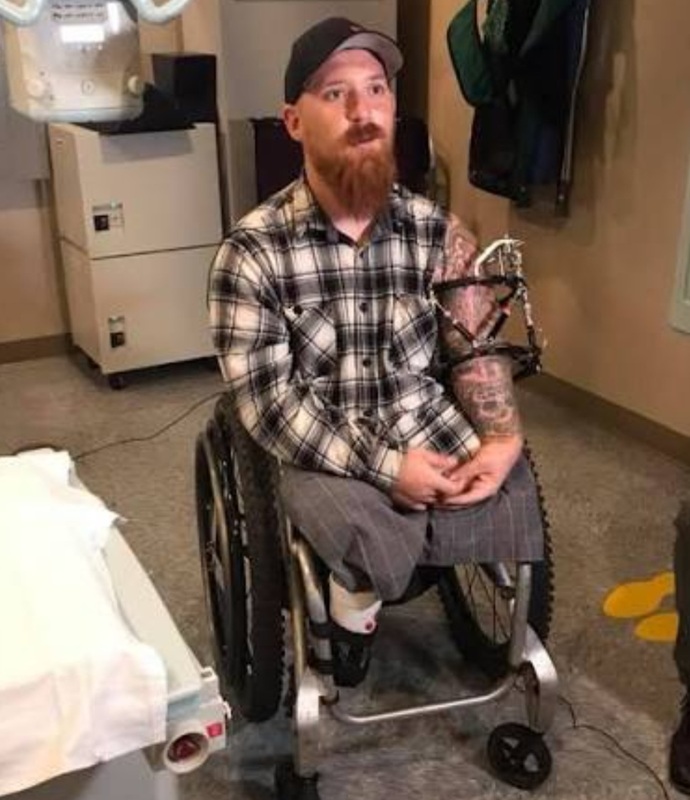 If a person suffers a permanent ugly injury that leaves them facial or limb disfigured and their man or woman decides to leave them, understandable?