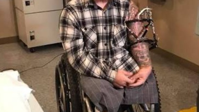 If a person suffers a permanent ugly injury that leaves them facial or limb disfigured and their man or woman decides to leave them, understandable?