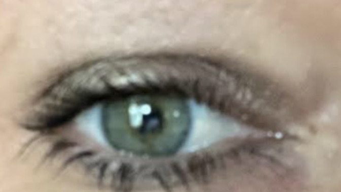 I’m not sure if you can see it but I have a sty in my eye, what’s the best thing to do for it?