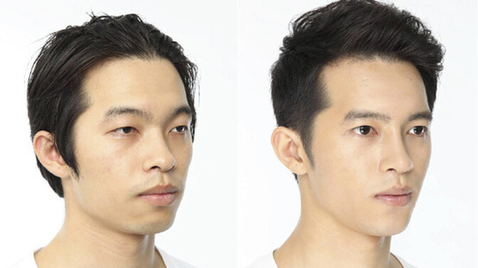 Would you date someone who has had some form of plastic surgery?