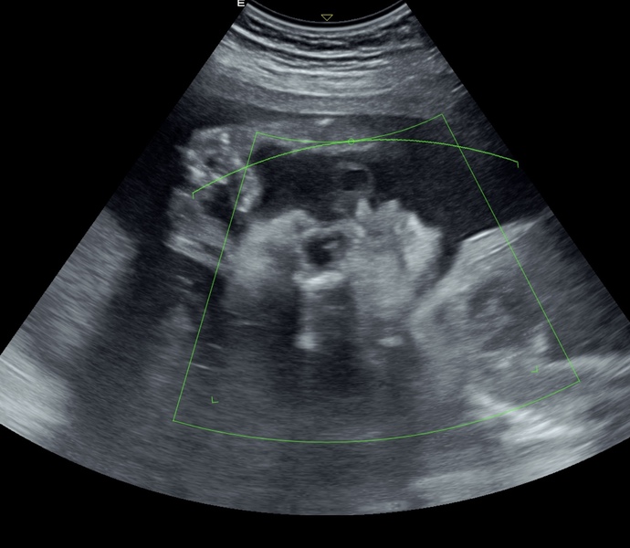 Does anyone else feel like my baby’s arms are fucking long?