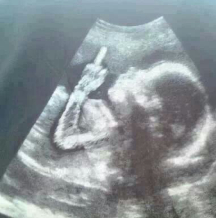 Does anyone else feel like my baby’s arms are fucking long?