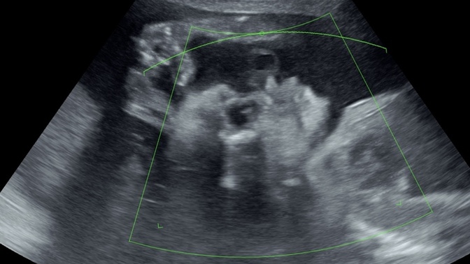 Does anyone else feel like my baby’s arms are fucking long?