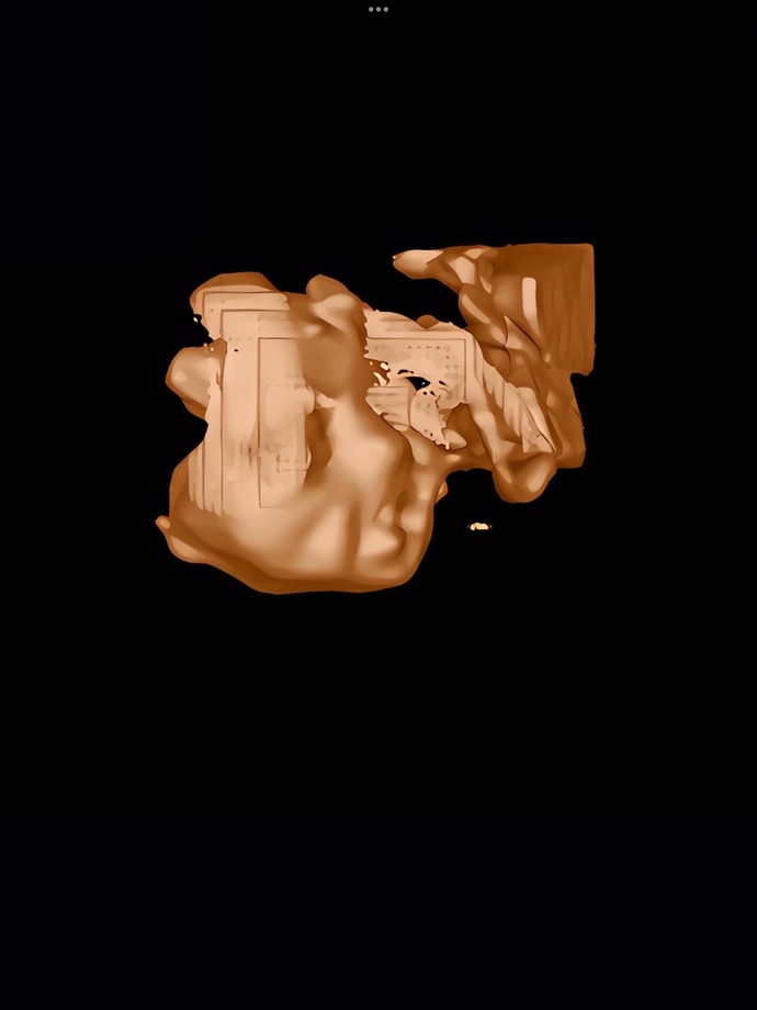 3d ultrasound FAIL?