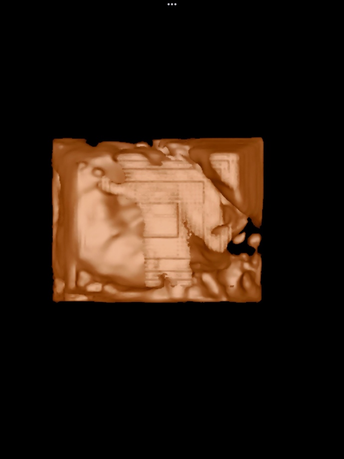 3d ultrasound FAIL?