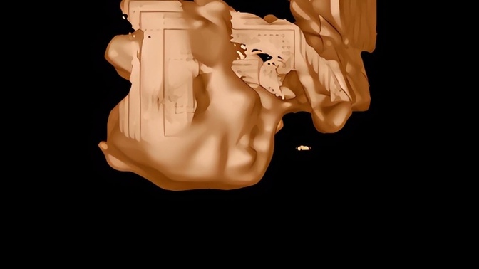 3d ultrasound FAIL?
