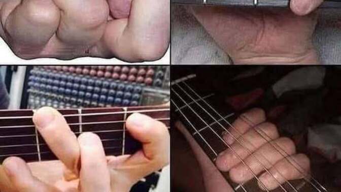 What do you think is the most frustrating part about learning guitar?