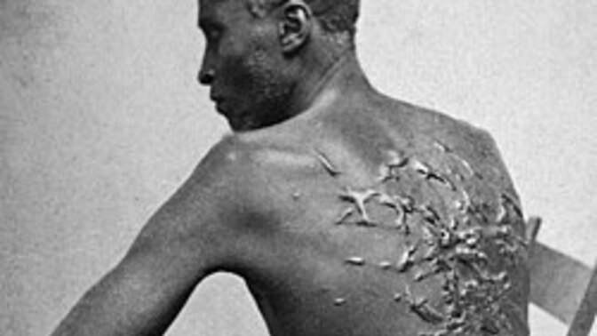 We sure reparations wouldn't be just?