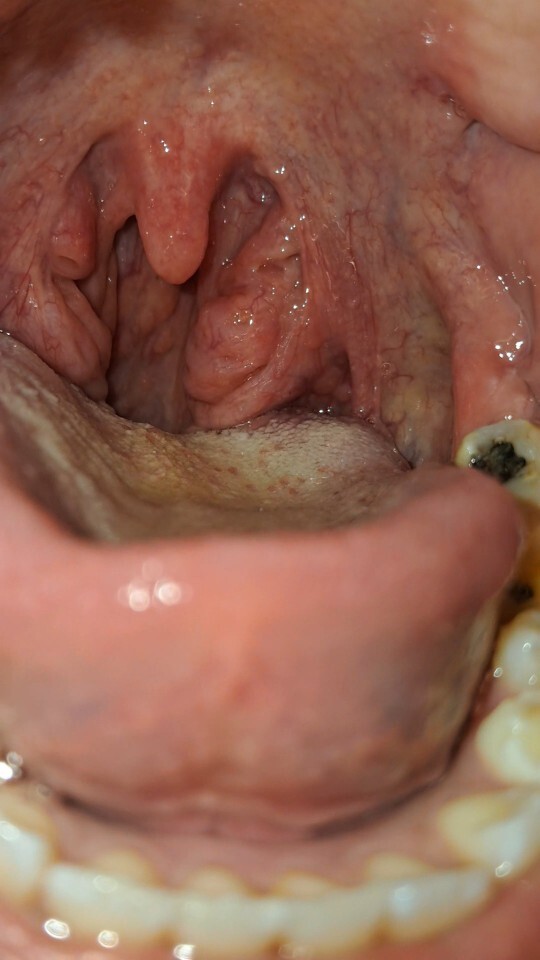 How bad has a cold had you?