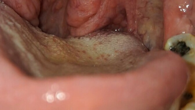 How bad has a cold had you?