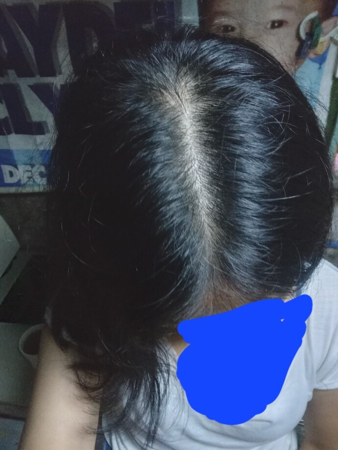 Do I have a healthy hair?