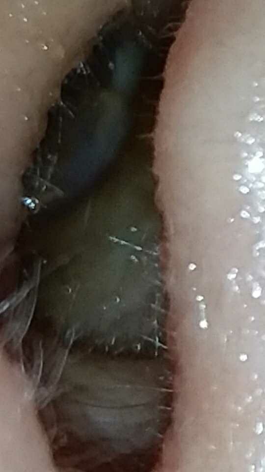 Please help if you can Medical advice?