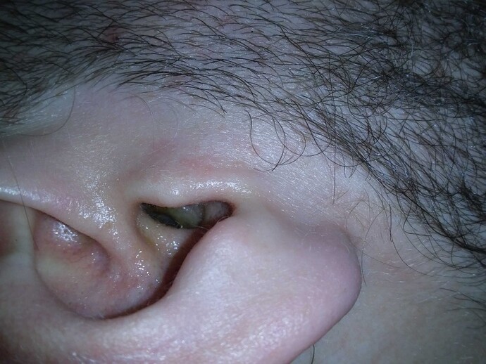 Please help if you can Medical advice?