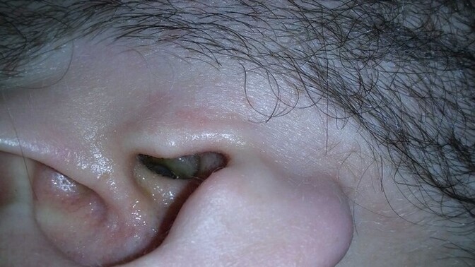 Please help if you can Medical advice?