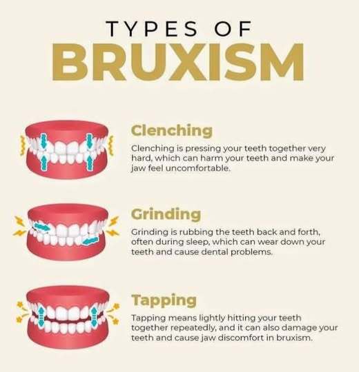 Have you ever woken up while grinding your teeth?