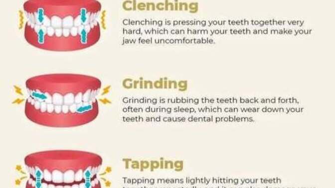 Have you ever woken up while grinding your teeth?