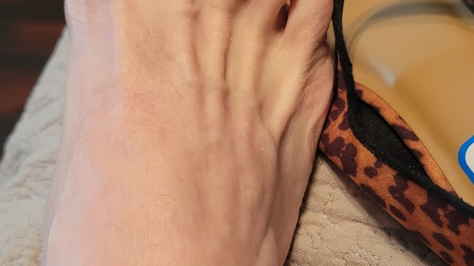 Does Anybody Do Their Toes for Christmas?