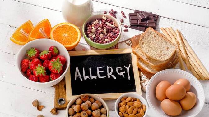 Do you have any food allergies?