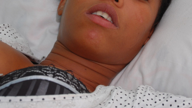 So I have these deep necklines & always feel like something is crawling on it but doctors told me it microscopic bugs on my necklines, is this true?