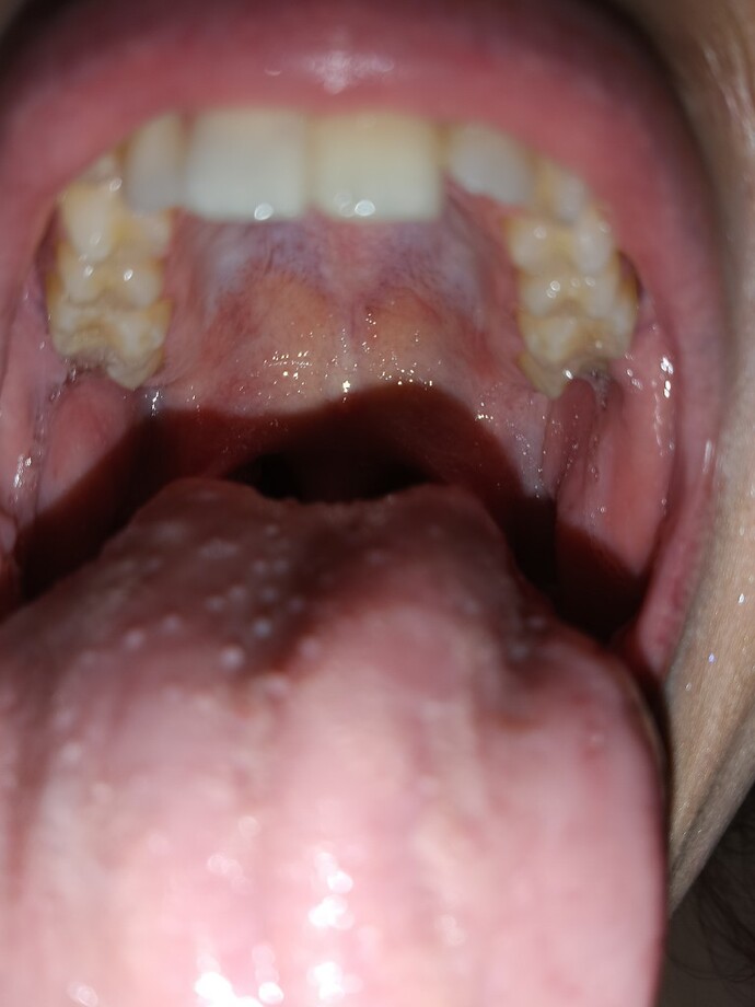 Is this herpes? Visiting a man friend for a trip in TWO days?