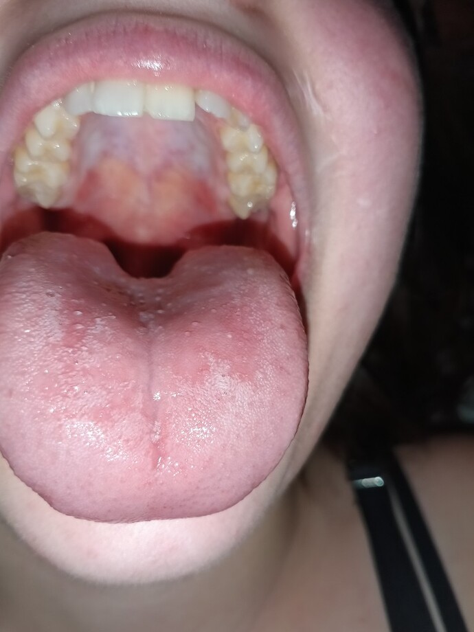Is this herpes? Visiting a man friend for a trip in TWO days?