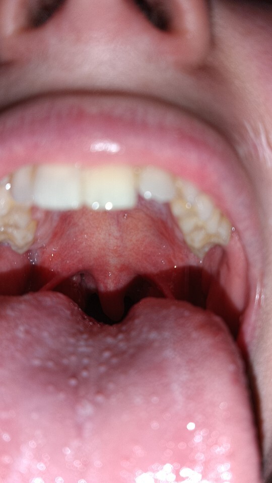 Is this herpes? Visiting a man friend for a trip in TWO days?