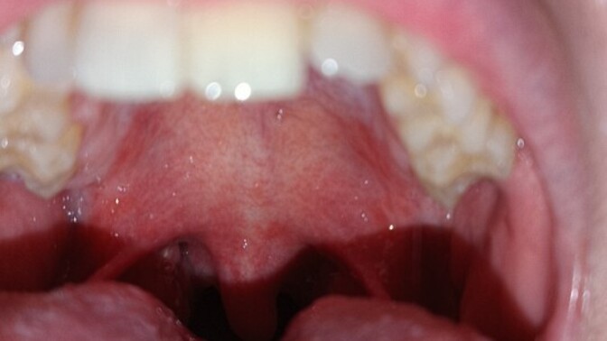 Is this herpes? Visiting a man friend for a trip in TWO days?