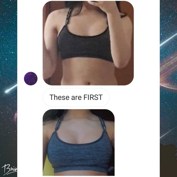 Would you get hypnotic breast enhancement?