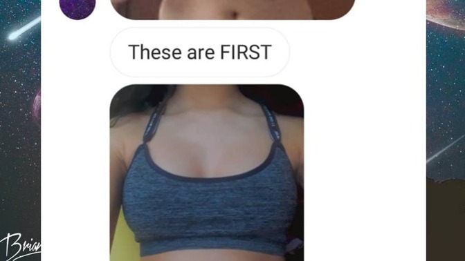 Would you get hypnotic breast enhancement?