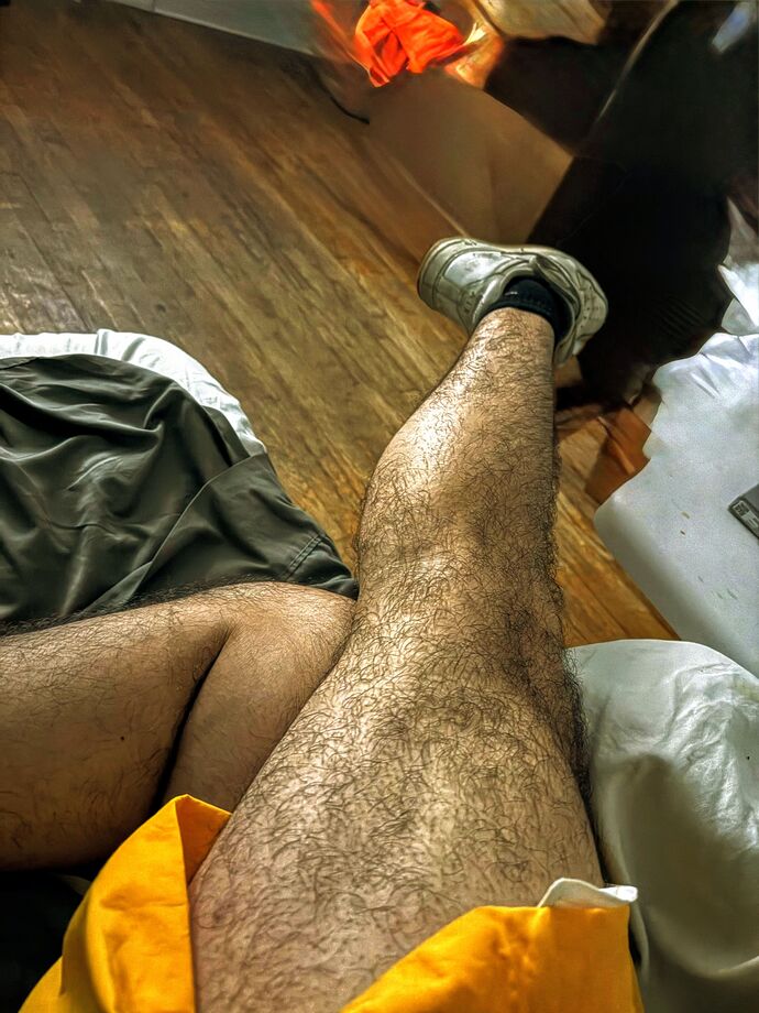 Too much leg and thigh hair on a man?