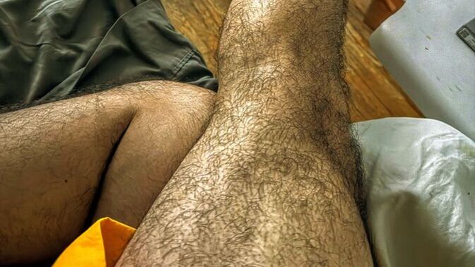 Too much leg and thigh hair on a man?