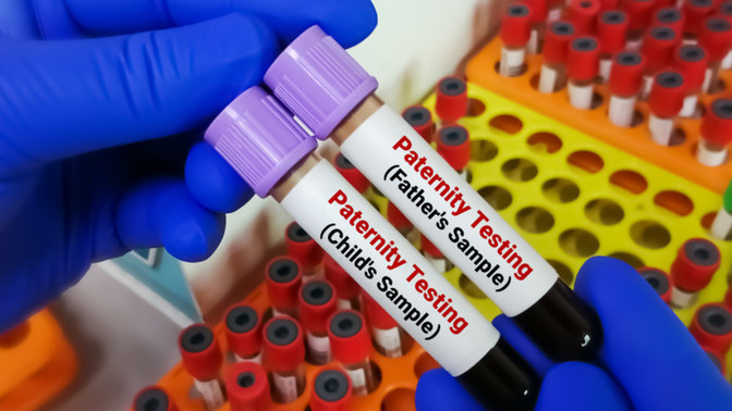Should paternity testing be mandatory at birth?