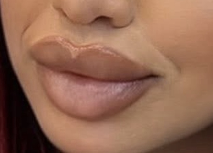 Do people really think those kind of lips are beautiful?