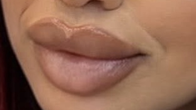 Do people really think those kind of lips are beautiful?