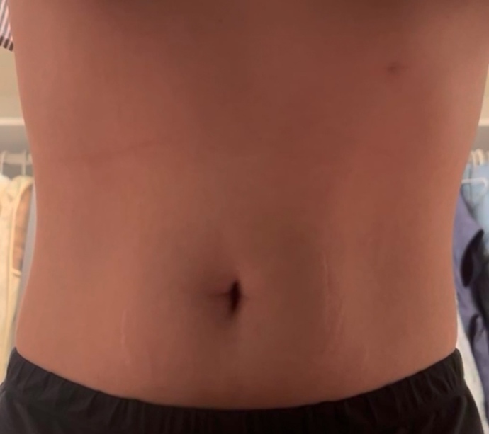 Would you consider this abs?